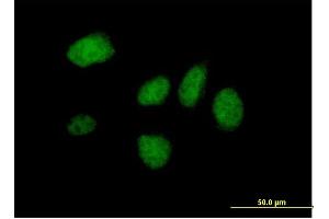 Immunofluorescence of purified MaxPab antibody to DIDO1 on HeLa cell. (DIDO1 Antikörper  (AA 1-544))