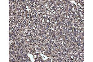 IHC analysis of SLU7 using anti-SLU7 antibody (ABIN7601697). (SLU7 Antikörper  (AA 42-474))