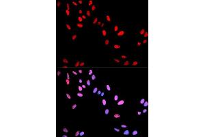 Immunofluorescence analysis of U2OS cell using Phospho-MYC-T58 antibody. (c-MYC Antikörper  (pThr58))