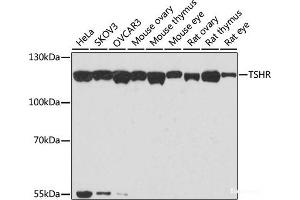 Western blot analysis of extracts of various cell lines using TSHR Polyclonal Antibody at dilution of 1:1000. (TSH receptor Antikörper)