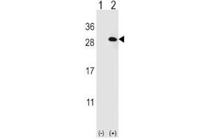 Western blot analysis of EIF4E2 antibody and 293 cell lysate (2 ug/lane) either nontransfected (Lane 1) or transiently transfected (2) with the EIF4E2 gene. (EIF4E2 Antikörper)