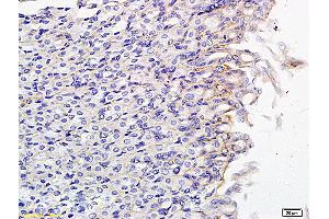 Formalin-fixed and paraffin embedded mouse small intestine labeled with Anti SLCO2B1 Polyclonal Antibody, Unconjugated (ABIN751048) followed by conjugation to the secondary antibody and DAB staining (SLCO2B1 Antikörper  (AA 531-630))