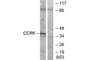 Western blot analysis of extracts from RAW264. (CCRK Antikörper  (AA 31-80))