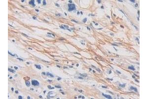 Immunohistochemistry (IHC) image for anti-Periostin (POSTN) (AA 97-230) antibody (ABIN7436453)