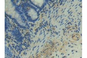 Immunohistochemistry (IHC) image for anti-Neuropilin 1 (NRP1) (AA 646-814) antibody (ABIN7432400)