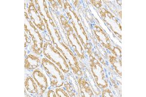 Immunofluorescence (IF) image for anti-Family with Sequence Similarity 82, Member A2 (FAM82A2) (AA 171-470) antibody (ABIN6146979)