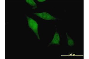 Immunofluorescence of purified MaxPab antibody to AGGF1 on HeLa cell.