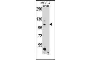 Western blot analysis of HIPK1 Antibody (C-term) Cat. (HIPK1 Antikörper  (C-Term))