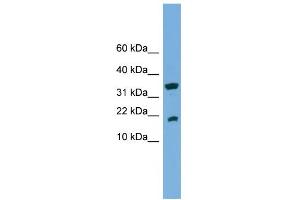 WB Suggested Anti-ACP1 Antibody Titration:  0.