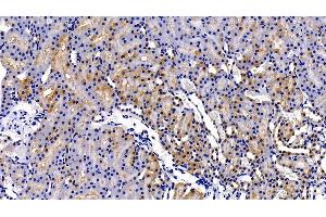 Immunohistochemistry (IHC) image for anti-Matrix Metallopeptidase 7 (Matrilysin, Uterine) (MMP7) (AA 1-267) antibody (ABIN7431020)