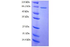 SDS-PAGE (SDS) image for Lectin, Galactoside-Binding, Soluble, 3 Binding Protein (LGALS3BP) (AA 19-574) protein (His tag) (ABIN7584961)