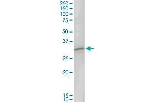 MAGEA8 MaxPab rabbit polyclonal antibody. (MAGEA8 Antikörper  (AA 1-318))