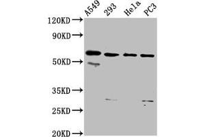 Western Blot Positive WB detected in: A549 whole cell lysate, 293 whole cell lysate, Hela whole cell lysate, PC-3 whole cell lysate All lanes: DDX28 antibody at 6. (DDX28 Antikörper  (AA 71-206))