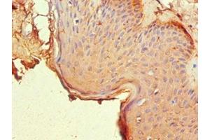 Immunohistochemistry of paraffin-embedded human skin tissue using ABIN7161902 at dilution of 1:100 (NR2C1 Antikörper  (AA 1-240))