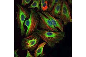 Immunofluorescence analysis of HeLa cells using BID monoclonal antibody, clone 3C5  (green). (BID Antikörper)