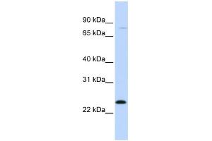 WB Suggested Anti-MX1 Antibody Titration: 0. (MX1 Antikörper  (C-Term))