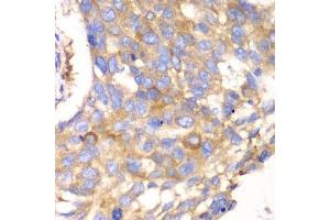 Immunohistochemistry (Paraffin-embedded Sections) (IHC (p)) image for anti-Calpain, Small Subunit 1 (CAPNS1) (AA 69-268) antibody (ABIN6137928)