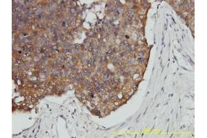 Image no. 2 for anti-Prefoldin Subunit 3 (PFDN3) (AA 1-198) antibody (ABIN466118) (VBP1 Antikörper  (AA 1-198))