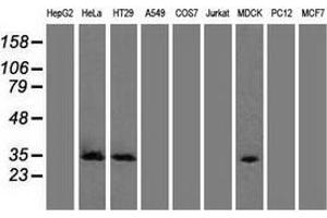 Western blot analysis of extracts (35 µg) from 9 different cell lines by using anti-CDK5 monoclonal antibody. (CDK5 Antikörper)