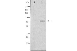 Western blot analysis of extracts from HT-29 cells, using Cytochrome P450 2B6 antibody. (CYP2B6 Antikörper  (Internal Region))