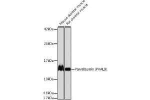 Western blot analysis of extracts of various cell lines, using Parvalbumin (PVALB) (PVALB) antibody (ABIN7269182) at 1:1000 dilution. (PVALB Antikörper)