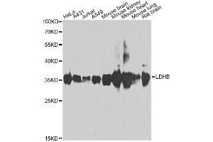 Western blot analysis of extracts of various cell lines, using LDHB antibody (ABIN2563654) at 1:1000 dilution. (LDHB Antikörper)