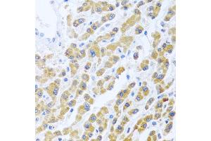 Immunohistochemistry of paraffin-embedded human liver using MANF antibody at dilution of 1:100 (40x lens).