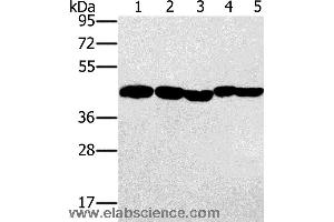 Western blot analysis of Hela, skov3 and A549 cell, mouse liver and human ovarian cancer tissue, using PON1 Polyclonal Antibody at dilution of 1:500 (PON1 Antikörper)