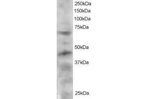 ABIN2560349 staining (2µg/ml) of HeLa lysate (RIPA buffer, 30µg total protein per lane). (TRF1 Antikörper  (C-Term))
