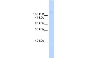 WB Suggested Anti-DYSF Antibody Titration:  0. (Dysferlin Antikörper  (N-Term))