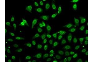 Immunofluorescence analysis of A549 cells using GCA antibody (ABIN5974261). (Grancalcin Antikörper)