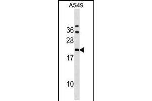 Western blot analysis in A549 cell line lysates (35ug/lane). (GRPEL2 Antikörper  (N-Term))