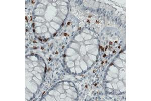 Immunohistochemical staining (Formalin-fixed paraffin-embedded sections) of human rectum with CD3E monoclonal antibody, clone CL1497  shows strong immunoreactivity in a subset of lymphoid cells. (CD3 epsilon Antikörper  (AA 25-126))