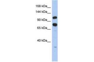 Image no. 1 for anti-Zinc Finger RNA Binding Protein (ZFR) (C-Term) antibody (ABIN6742482) (ZFR Antikörper  (C-Term))