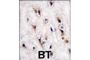 Immunohistochemistry (Paraffin-embedded Sections) (IHC (p)) image for anti-Nuclear Receptor Subfamily 4, Group A, Member 2 (NR4A2) (AA 13-42), (N-Term) antibody (ABIN390383)