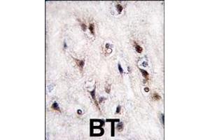 Formalin-fixed and paraffin-embedded human brain tissue reacted with NURR1 (NR4A2) antibody (N-term) (ABIN390383 and ABIN2840784) , which was peroxidase-conjugated to the secondary antibody, followed by DAB staining. (NR4A2 Antikörper  (N-Term))