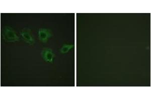 Immunofluorescence analysis of A549 cells, using MYPT1 (Phospho-Thr696) Antibody. (PPP1R12A Antikörper  (pThr696))