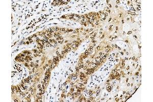 IHC analysis of Emerin using anti-Emerin antibody (ABIN4886569). (Emerin Antikörper  (N-Term))