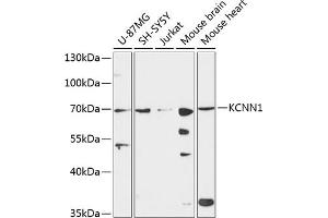 Western blot analysis of extracts of various cell lines, using KCNN1 antibody (ABIN6130514, ABIN6142765, ABIN6142767 and ABIN6224976) at 1:3000 dilution. (KCNN1 Antikörper  (AA 1-90))