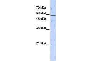 WB Suggested Anti-GLUD2 Antibody Titration: 0. (GLUD2 Antikörper  (N-Term))