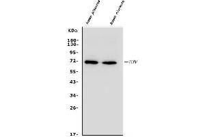 Western blot analysis of ALPP using anti-ALPP antibody (ABIN4886453). (PLAP Antikörper  (C-Term))