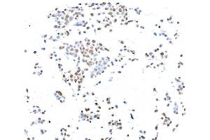Immunocytochemistry (ICC) image for anti-CCCTC-Binding Factor (Zinc Finger Protein) (CTCF) (AA 650-700) antibody (ABIN7453967) (Rekombinanter CTCF Antikörper  (AA 650-700))