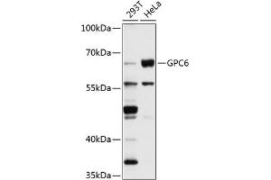 Western blot analysis of extracts of various cell lines, using GPC6 antibody (ABIN1680073, ABIN1680074, ABIN5664142 and ABIN6219786) at 1:1000 dilution. (Glypican 6 Antikörper  (AA 320-530))