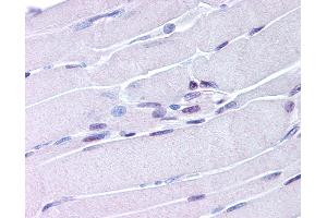 Immunohistochemistry (IHC) image for anti-Nuclear Receptor Subfamily 4, Group A, Member 1 (NR4A1) (AA 251-266) antibody (ABIN213736)