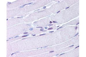 Anti-NUR77 antibody IHC of human skeletal muscle. (NR4A1 Antikörper  (AA 251-266))