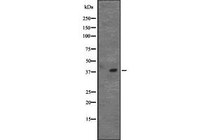 Western blot analysis of CD5L expression in Raji cell lysate,The lane on the left is treated with the antigen-specific peptide. (CD5L Antikörper  (C-Term))