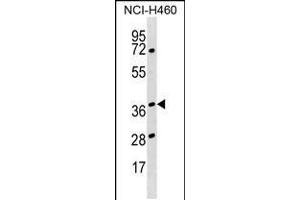 Western blot analysis in NCI-H460 cell line lysates (35ug/lane). (HNRNPH3 Antikörper  (AA 90-117))