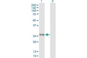 Western Blot analysis of PPP2R3B expression in transfected 293T cell line by PPP2R3B MaxPab polyclonal antibody. (PPP2R3B Antikörper  (AA 1-176))