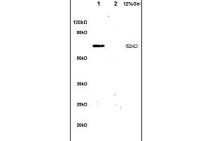Formalin-fixed and paraffin embedded rat colitis labeled with Anti-IL-1R1/CD121a/IL1 Receptor I Polyclonal Antibody, Unconjugated (ABIN747743) at 1:200 followed by conjugation to the secondary antibody and DAB staining. (IL1R1 Antikörper  (AA 481-569))