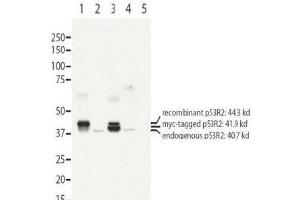 Image no. 1 for anti-Ribonucleotide Reductase M2 B (TP53 Inducible) (RRM2B) (N-Term) antibody (ABIN401481) (RRM2B Antikörper  (N-Term))